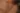 Placeholder blur